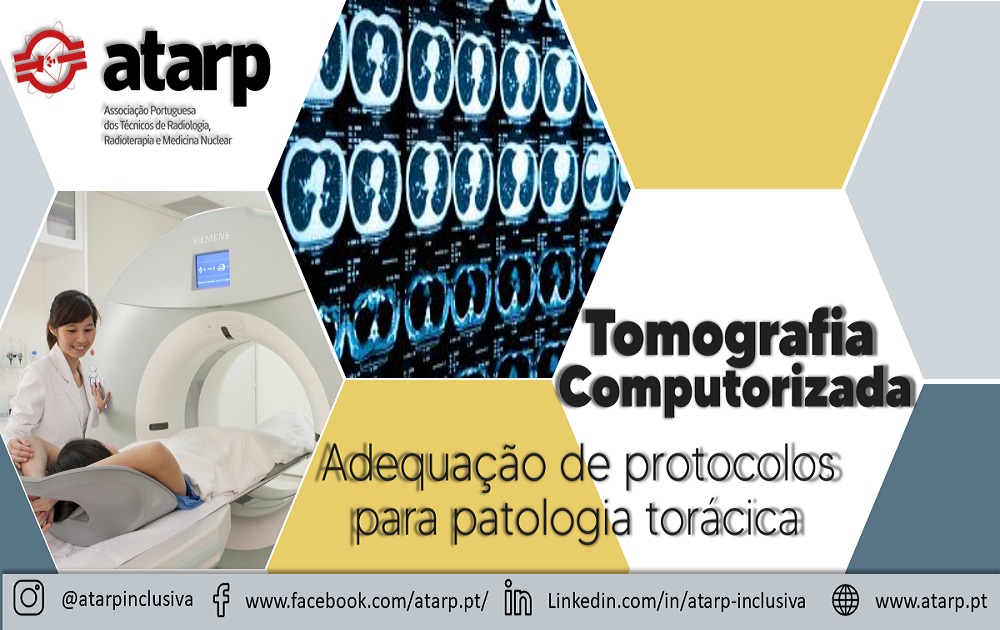 Curso Online Tomografia Computorizada - Adequação de protocolo para patologia torácica SESSÃO II